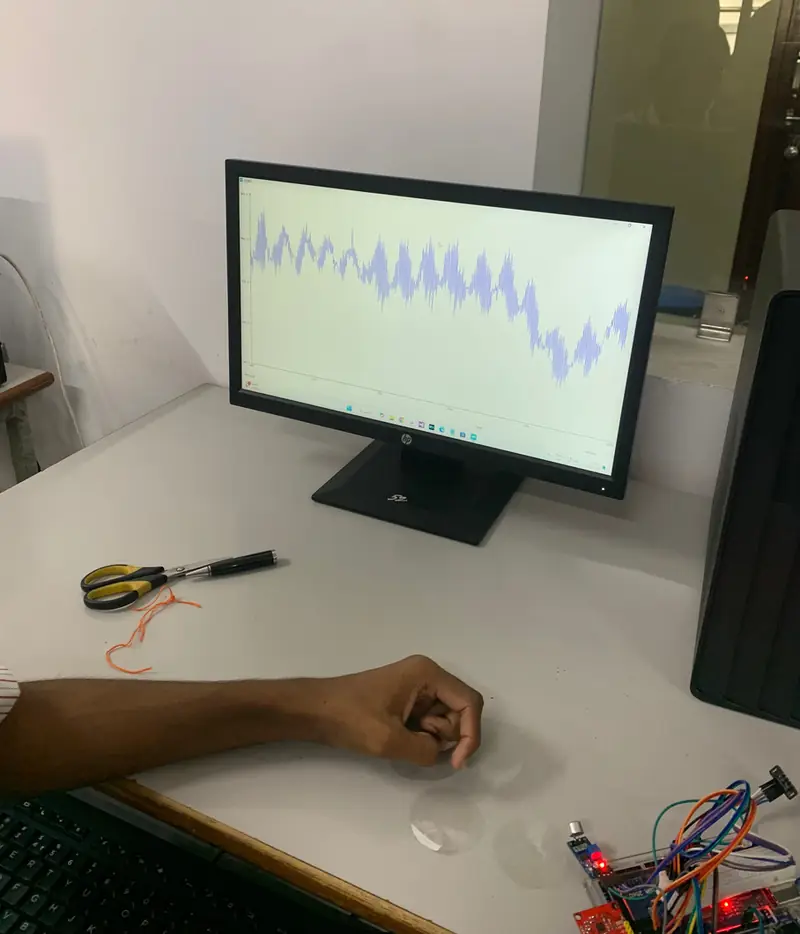 Real prototype test: a live ECG trace on a monitor while electrodes sit on a forearm